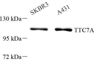 Western blot analysis of TTC7A (ABIN7075875) at dilution of 1: 1000