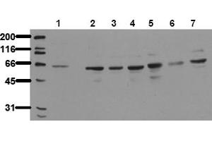 Western Blotting (WB) image for anti-P21-Activated Kinase 4 (PAK4) antibody (ABIN492621) (PAK4 antibody)