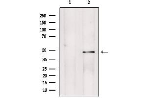 Western blot analysis of extracts from ratbrain, using PMPCB antibody.