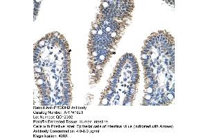 Rabbit Anti-PRODH2 Antibody  Paraffin Embedded Tissue: Human Intestine Cellular Data: Epithelial cells of intestinal villas Antibody Concentration: 4. (PRODH2 antibody  (C-Term))