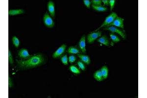 Immunofluorescent analysis of HepG2 cells using ABIN7151278 at dilution of 1:100 and Alexa Fluor 488-congugated AffiniPure Goat Anti-Rabbit IgG(H+L) (TRIM4 antibody  (AA 1-118))