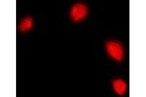 Immunofluorescent analysis of IFI16 staining in U2OS cells. (IFI16 antibody)