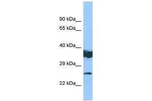 WB Suggested Anti-LYPLAL1 Antibody Titration: 1.