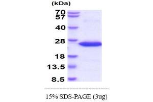 SDS-PAGE (SDS) image for Frataxin (FXN) (AA 42-210) protein (His tag) (ABIN667758)
