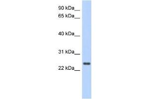 WB Suggested Anti-CCDC70 Antibody Titration: 0. (CCDC70 antibody  (Middle Region))