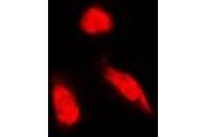 Immunofluorescent analysis of NCK1 staining in Hela cells. (NCK1 antibody)