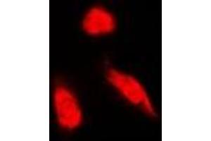 Immunofluorescent analysis of NCK1 staining in Hela cells.