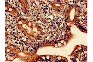 Immunohistochemistry of paraffin-embedded human small intestine tissue using ABIN7155233 at dilution of 1:100