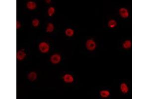 ABIN6266532 staining HepG2 by IF/ICC. (E2F6 antibody  (Internal Region))