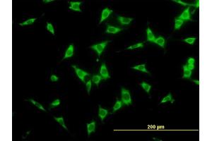 Immunofluorescence of monoclonal antibody to NCOA4 on NIH/3T3 cell. (NCOA4 antibody  (AA 505-614))