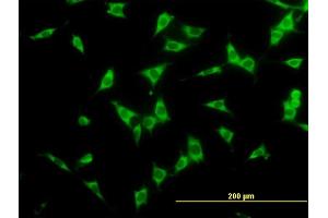 Immunofluorescence of monoclonal antibody to NCOA4 on NIH/3T3 cell. (NCOA4 antibody  (AA 505-614))
