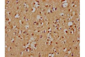 IHC image of ABIN7157954 diluted at 1:200 and staining in paraffin-embedded human brain tissue performed on a Leica BondTM system. (RANBP3L antibody  (AA 170-295))