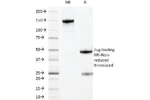 SDS-PAGE Analysis Purified MYADM Mouse Monoclonal Antibody (MYADM/971). (MYADM antibody)