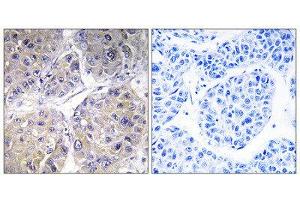 Immunohistochemistry (IHC) image for anti-Solute Carrier Family 27 (Fatty Acid Transporter), Member 5 (SLC27A5) (Internal Region) antibody (ABIN1850922) (SLC27A5 antibody  (Internal Region))