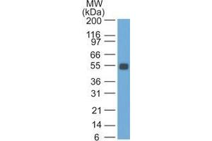 Western Blot Analysis of rat Colon lysate probed with Ep-CAM Monoclonal Antibody (SPM534). (EpCAM antibody)