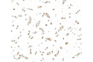 Immunocytochemistry (ICC) image for anti-Jun Dimerization Protein 2 (JDP2) (AA 50-100) antibody (ABIN7795635)