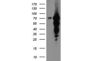 Western Blotting (WB) image for anti-Epsin 2 (EPN2) antibody (ABIN1498052) (Epsin 2 antibody)
