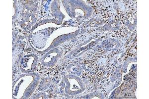 IHC analysis of Tropomyosin 2/TPM2 using anti-Tropomyosin 2/TPM2 antibody (ABIN7603245).