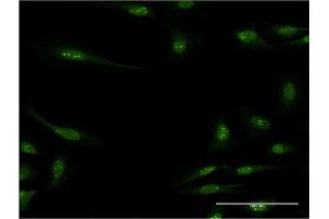 Immunofluorescence of monoclonal antibody to RBM15 on HeLa cell. (RBM15 antibody  (AA 701-810))