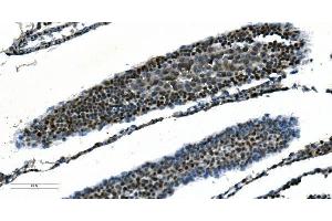 IHC analysis of CDC45L using anti-CDC45L antibody (ABIN7600230). (CDC45 antibody  (AA 166-431))