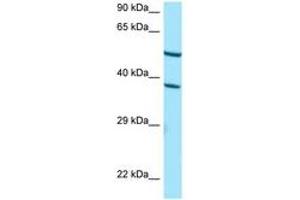 Image no. 1 for anti-Cytochrome P450, Family 4, Subfamily F, Polypeptide 2 (CYP4F2) (AA 288-337) antibody (ABIN6748419) (CYP4F2 antibody  (AA 288-337))