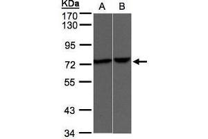 WB Image Sample(30 μg of whole cell lysate) A:A431, B:Raji, 7. (TRPV2 antibody  (C-Term))