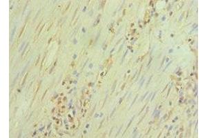 Immunohistochemistry of paraffin-embedded human epityphlon tissue using ABIN7172390 at dilution of 1:100