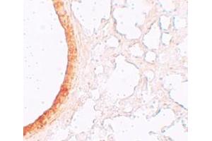 Immunohistochemistry (IHC) image for anti-Solute Carrier Family 39 (Zinc Transporter), Member 3 (SLC39A3) (Middle Region) antibody (ABIN1031179) (SLC39A3 antibody  (Middle Region))