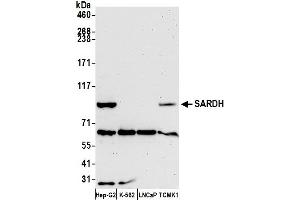 Western Blotting (WB) image for anti-Sarcosine Dehydrogenase (SARDH) (AA 868-918) antibody (ABIN7452667)