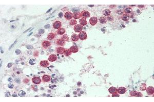 Detection of HMMR in Human Testis Tissue using Polyclonal Antibody to Hyaluronan Mediated Motility Receptor (HMMR) (HMMR antibody  (AA 577-724))