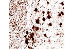 IHC staining of human brain with PGP9. (UCHL1 antibody)