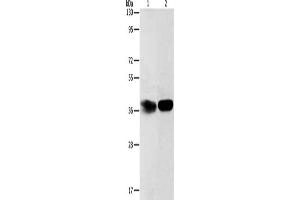 Gel: 12 % SDS-PAGE, Lysate: 40 μg, Lane 1-2: Hela cells, mouse kidney tissue, Primary antibody: ABIN7189696(ADPRHL2 Antibody) at dilution 1/500, Secondary antibody: Goat anti rabbit IgG at 1/8000 dilution, Exposure time: 2 minutes (ADPRHL2 antibody)