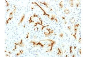 Formalin-fixed, paraffin-embedded human Pancreas stained with CFTR Rabbit Recombinant Monoclonal Antibody (CFTR/1775R). (Recombinant CFTR antibody  (AA 258-385))