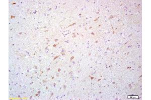 Formalin-fixed and paraffin embedded rat brain labeled with Rabbit Anti- Scavenger receptor class B member 1 Polyclonal Antibody, Unconjugated (ABIN738936) at 1:200 followed by conjugation to the secondary antibody and DAB staining