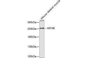Western blot analysis of extracts of Mouse skeletal muscle using MYH6 Polyclonal Antibody. (MYH6 antibody)