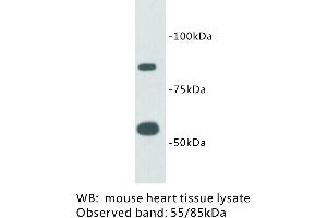 Image no. 1 for anti-Transmembrane Protein 2 (TMEM2) antibody (ABIN1112936) (TMEM2 antibody)