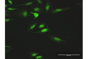 Immunofluorescence of purified MaxPab antibody to HCK on HeLa cell. (HCK antibody  (AA 1-505))