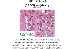 Image no. 1 for anti-Chemokine (C-X-C Motif) Receptor 4 (CXCR4) antibody (ABIN1724035) (CXCR4 antibody)