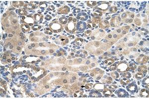 Human kidney (HFE antibody  (C-Term))