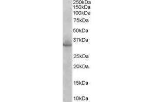 Western Blotting (WB) image for anti-Coiled-Coil Domain Containing 114 (CCDC114) (C-Term) antibody (ABIN2774525) (CCDC114 antibody  (C-Term))