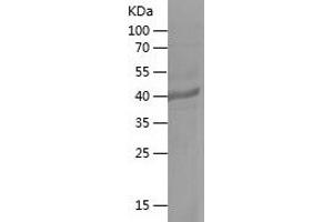 Western Blotting (WB) image for Fucosyltransferase 7 (Alpha (1,3) Fucosyltransferase) (FUT7) (AA 144-342) protein (His-IF2DI Tag) (ABIN7123014) (FUT7 Protein (AA 144-342) (His-IF2DI Tag))