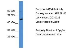 WB Suggested Anti-CD4  Antibody Titration: 0. (CD4 antibody  (C-Term))
