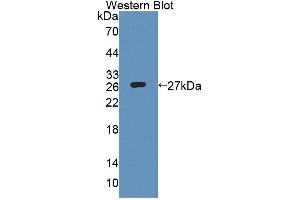 Detection of Recombinant COVA1, Human using Polyclonal Antibody to Cytosolic Ovarian Carcinoma Antigen 1 (COVA1) (ENOX2 antibody  (AA 1-207))