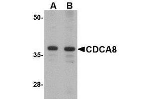 Western blot analysis of CDCA8 in Rat kidney lysate with AP30218PU-N CDCA8 antibody at (A) 1 and (B) 2 μg/ml.
