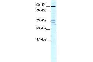 WB Suggested Anti-ZC3H7B Antibody Titration:  4ug/ml  Positive Control:  Human Liver (ZC3H7B antibody  (N-Term))