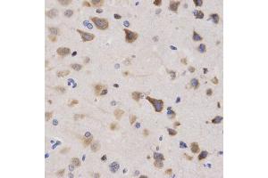 Immunohistochemistry of paraffin-embedded rat brain using KPNA4 Antibody (ABIN5971058) at dilution of 1/200 (40x lens). (KPNA4 antibody)