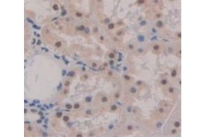 Used in DAB staining on fromalin fixed paraffin- embedded Kidney tissue (PYGO2 antibody  (AA 171-406))