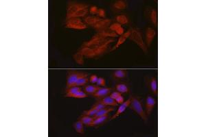 Immunofluorescence analysis of U2OS cells using EIF4ENIF1 Rabbit pAb (ABIN7267051) at dilution of 1:100 (40x lens).