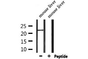 Western blot analysis of extracts from mouse liver, using FGF9 Antibody.