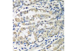 Immunohistochemistry of paraffin-embedded human stomach using CCT6A antibody at dilution of 1:100 (40x lens). (CCT6A antibody)